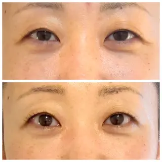 LaLa所属・小顔・たるみケア 専門店【&LaLa】のエステ・リラクイメージ