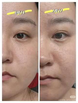 マツエク・マツパ aliaハイフ&水光ジェットサロン所属・aliaハーブ水光店 エステティシャン募集のエステ・リラクイメージ