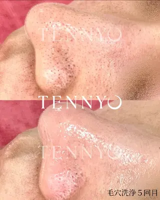 【クリニック提携】salon de moffyサロンドモフィ所属・【クリニック提携】 サロンドモフィ吉岡のエステ・リラクイメージ