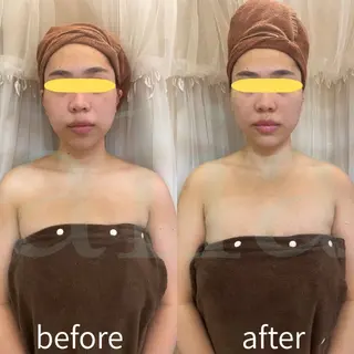 aliaハイフ&水光ジェットサロン所属・aliaハーブ水光店 エステティシャン募集のエステ・リラクイメージ