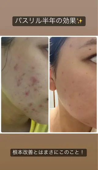 partir銀座店所属・横山 知子のエステ・リラクイメージ