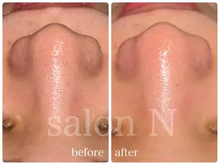 salonＮ所属・星野 マリアのエステ・リラクイメージ