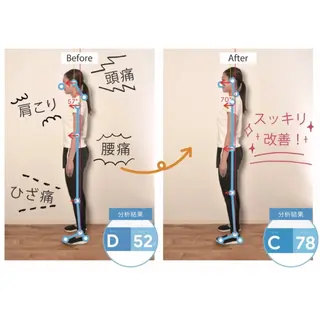 骨盤矯正・姿勢矯正 肩こり・腰痛整体のエステ・リラクイメージ