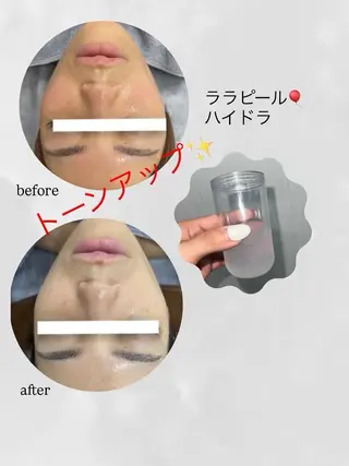 salon merci和泉のエステ・リラクイメージ