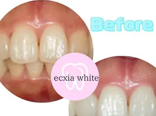 セルフホワイトニングサロン　エクシアホワイト西尾店所属・エクシアホワイト西尾 堀内恵のその他イメージ