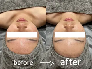 NAZ  (ナーズ)のエステ・リラクイメージ