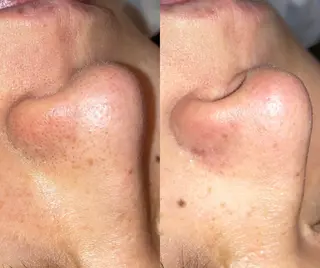 Mother TOKYOのエステ・リラクイメージ