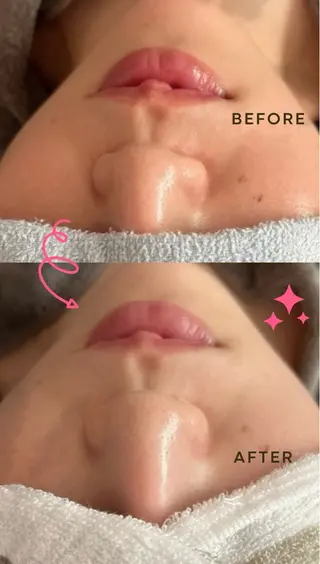 miii eriのエステ・リラクイメージ