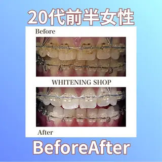 ホワイトニングショップ西原所属・下川 藍子のその他イメージ