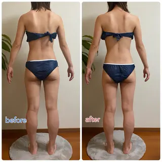 ACORAL痩身 NAZUKIのエステ・リラクイメージ