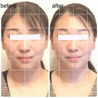 小顔矯正ドライヘッド Arincoのエステ・リラクイメージ