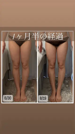 Beautysalon YURA所属・リンパ＆小顔美肌 YURA/Ayakaのエステ・リラクイメージ