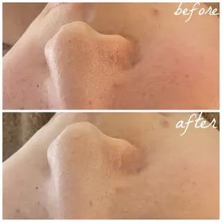 メンズ メナード岐阜市茜部 杉浦のエステ・リラクイメージ