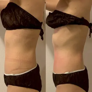 【コスパ最強痩身】 GRANDIRのエステ・リラクイメージ