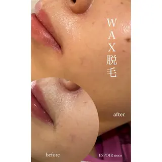ワックス脱毛🌈 ESPOIRnocoのエステ・リラクイメージ