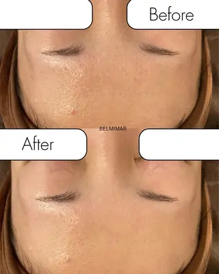 南森町・肌質改善 BELMIMARのエステ・リラクイメージ