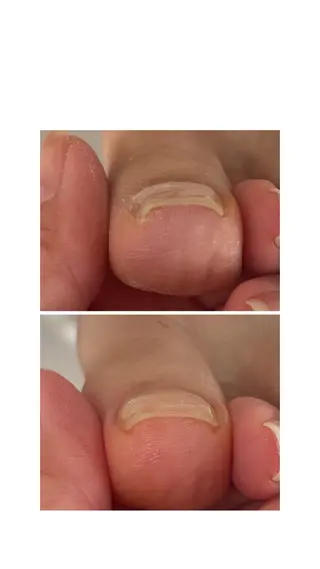 ネイル Alo.nail アロ•ネイルのネイルデザイン