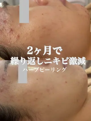 WHITE AQUA 北千住店のエステ・リラクイメージ