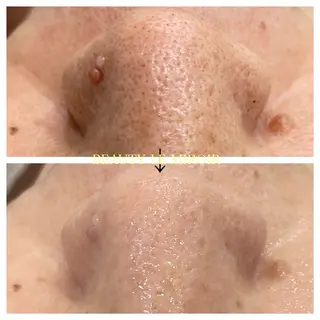 ビューティー ミロワールのエステ・リラクイメージ