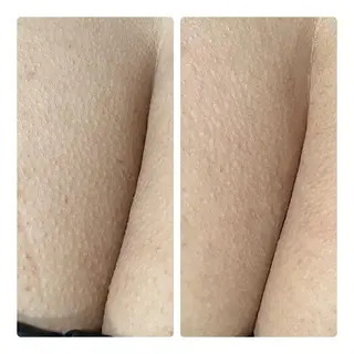 【足圧】鬼👹リンパ 身体整うサロンのエステ・リラクイメージ