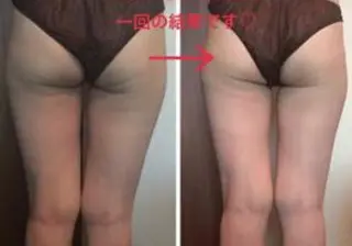 月のあかり所属・オイル＆フェイシャル 【月のあかり🌙】のエステ・リラクイメージ