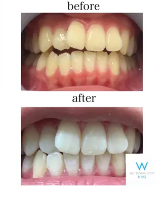 メンズ キッズ ホワイトニングショップ町田店所属・ホワイトニング ショップ町田店のその他イメージ