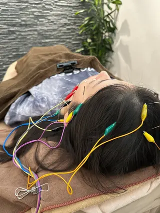 美容鍼灸整体サロンBeauJu所属・小顔矯/美容鍼/鍼灸 BeauJuのその他イメージ