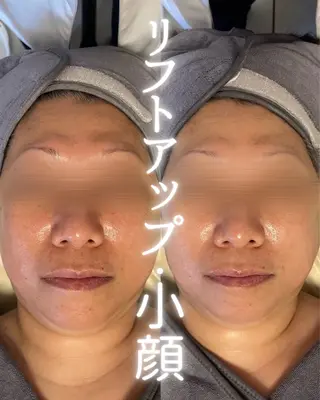 private beauty salon Lilby所属・リルビー 肌育・肌質改善サロンのその他イメージ