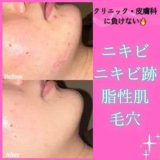 痩身&美肌サロン 堀米✨のその他イメージ