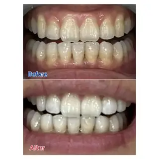 M渋谷店所属・M渋谷 ホワイトニングのエステ・リラクイメージ