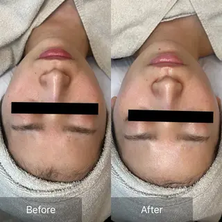 ebcs 8のエステ・リラクイメージ