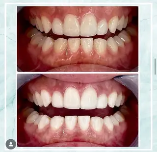 ホワイトニング ビューティ名古屋栄のその他イメージ