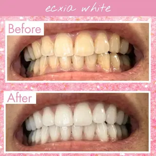 セルフホワイトニング エクシア宮崎花ヶ島店のその他イメージ