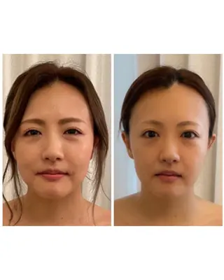 小顔コルギ＆オイル アンドエスのエステ・リラクイメージ