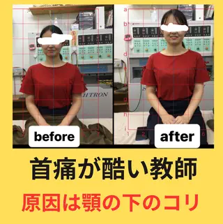 肩こり頭痛さようなら 整体カタギリのエステ・リラクイメージ