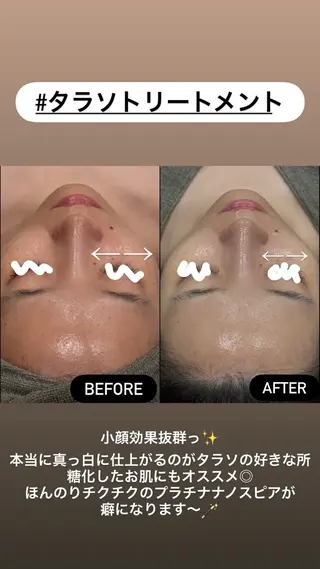 LiZA エステティックサロンのエステ・リラクイメージ