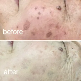 痛くないシミ取り 【荻窪】石橋のヘアスタイル