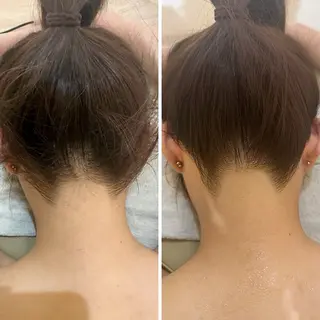 うなじ脱毛/美肌脱毛 LABELのエステ・リラクイメージ