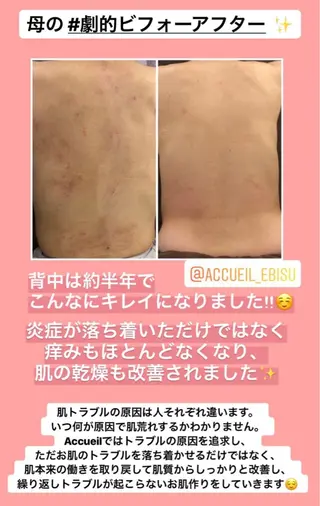 ミディアム カラー パーマ ヘアアレンジ メンズ キッズ ネイル マツエク・マツパ ニキビ・肌質改善専門 ♡人生が変わるサロンのエステ・リラクイメージ