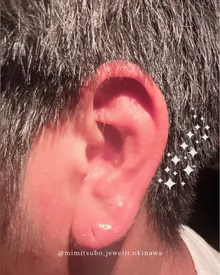 Jewelit所属・耳つぼジュエリー Jewelitのその他イメージ