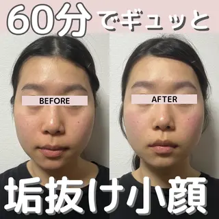 小顔矯正/骨格矯正 AKANEのエステ・リラクイメージ