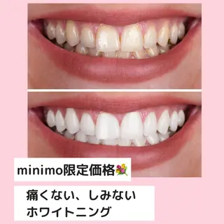 眉毛　まつげパーマ ルクス銀座店の眉毛・アイブロウイメージ