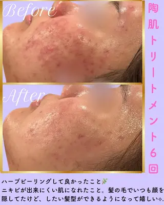 miki 東根の肌質改善サロンのエステ・リラクイメージ