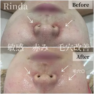 ブライダル痩身×脱毛 尼崎駅前サロンのエステ・リラクイメージ