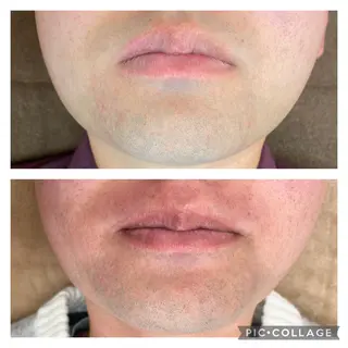 メンズ RE:moom リムーム/脱毛エステのエステ・リラクイメージ