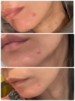 yellow.所属・yellow💛【 脱毛&フェイシャル】のエステ・リラクイメージ