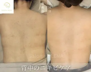 サロンドレナ名駅店所属・ハーブピーリング専門 サロンドレナ平岡のエステ・リラクイメージ