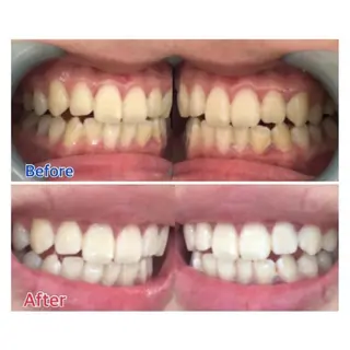 M渋谷店所属・M渋谷 ホワイトニングのエステ・リラクイメージ