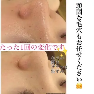 ミディアム カラー パーマ ヘアアレンジ メンズ キッズ ネイル マツエク・マツパ ニキビ・肌質改善専門 ♡人生が変わるサロンのエステ・リラクイメージ