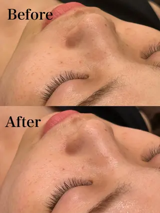 メンズ Hari Lounge梅田所属・natsuki ハリラウンジ梅田のエステ・リラクイメージ